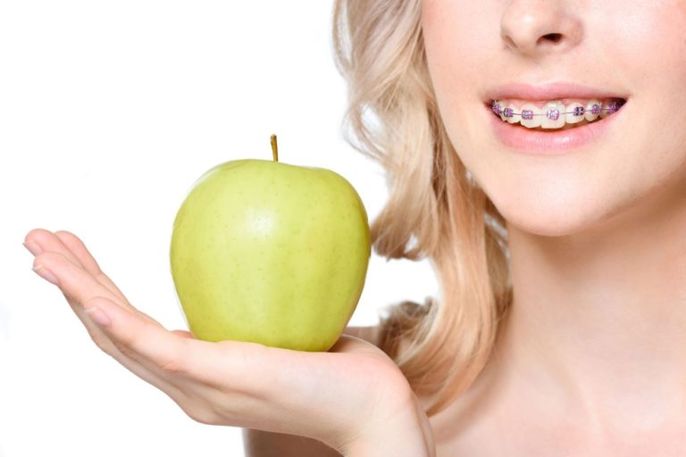 What Can You Eat With Braces The First Day List Of Top Meals Snacks