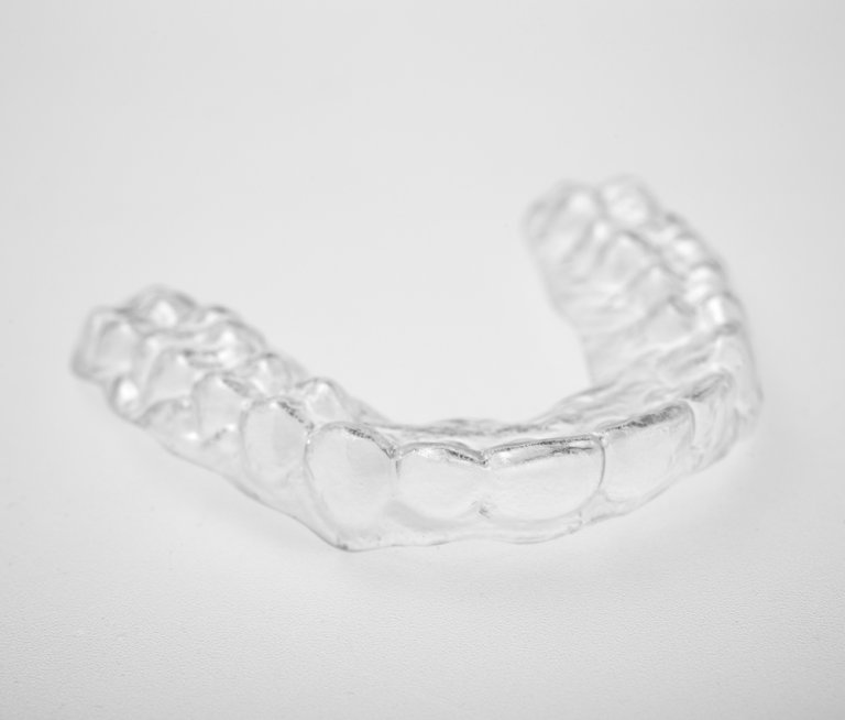 How Much Do Retainers Cost in the UK? Which Type is Best?