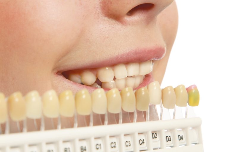 How Much Does Teeth Whitening Cost in the UK?