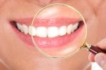 61878Blanqueamiento dental con limón: ¿Es el limón una solución ideal para los dientes blancos?