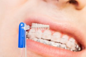 brossettes interdentaires utilisation interdental dentaire dentaly require
