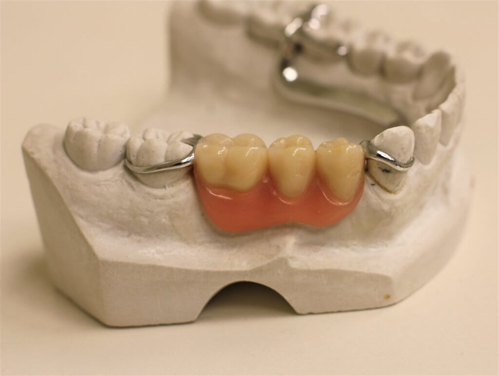 Dentures: Guide to False Teeth Types, Costs and More - Dentaly.org