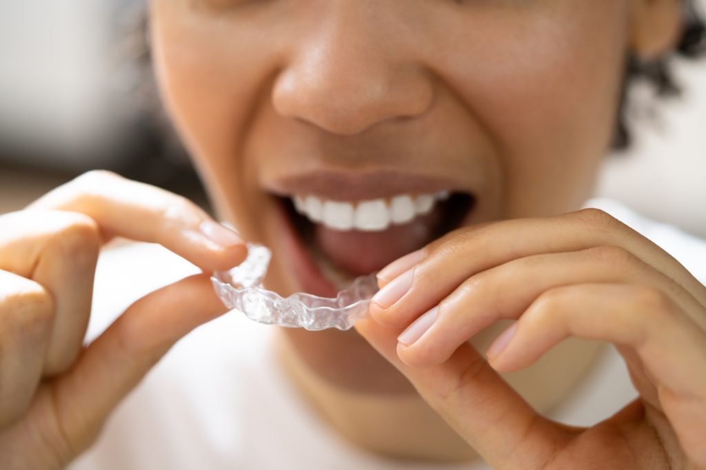 Does Medicaid Cover Invisalign? And Other Treatment Funding Options