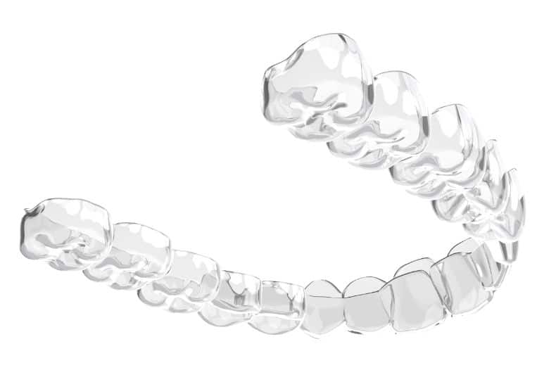 7 Easy Ways How To Clean Teeth Aligners at Home - Dentaly.org