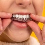 77849Night Guard Cost: How Much is a Mouth Guard for Teeth Grinding?